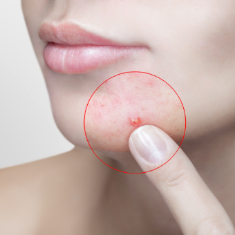 client points to chin 