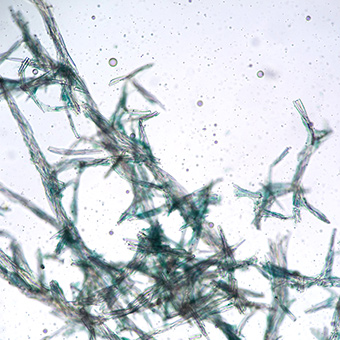 Spikulas of Acervochalina Copperinigi Ganimedes via Wikimedia Commons 