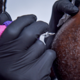 ASCP member performs scalp micropigmentation