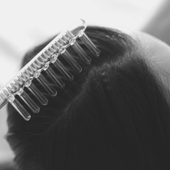 High frequency on the scalp