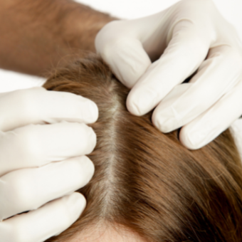 Scalp is examined