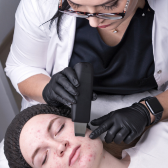 esthetician performs ultrasonic exfoliation